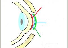 Fig. 1. Preocular tear film: the outer lipid layer (green), middle aqueous layer (blue) and inner mucin layer (red).